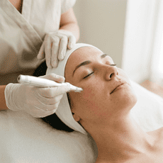 Microneedling Classic Behandlung im House of Beauty by Alma in Meerbusch